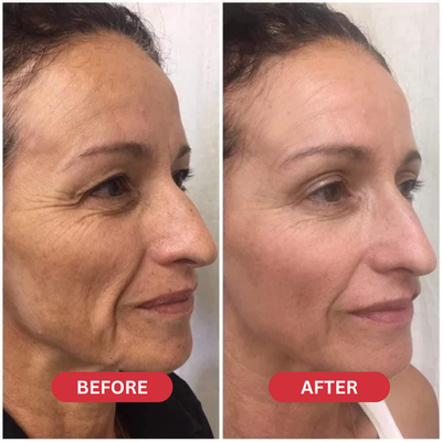 EveLare™ Korean Time Reverse Cream - Limited Stocks!