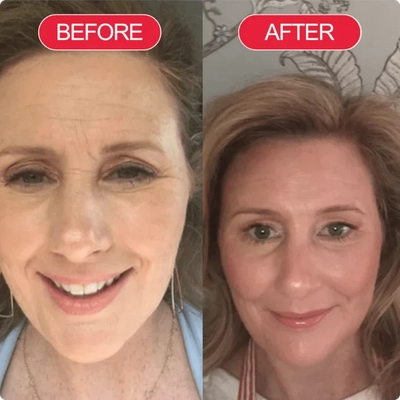 EveLare™ Korean Time Reverse Cream - Limited Stocks!
